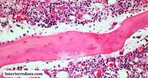 Adenoid tissue