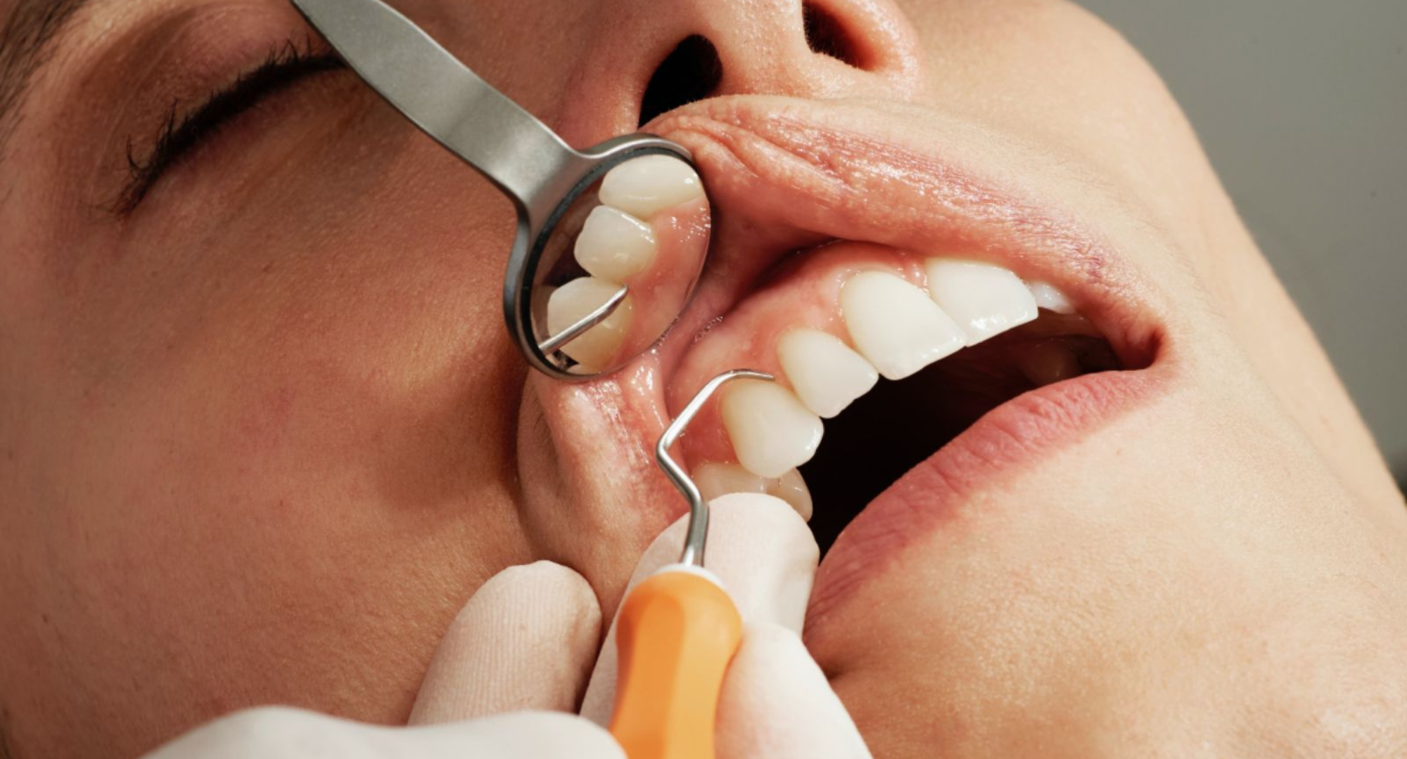 Dentist Trips